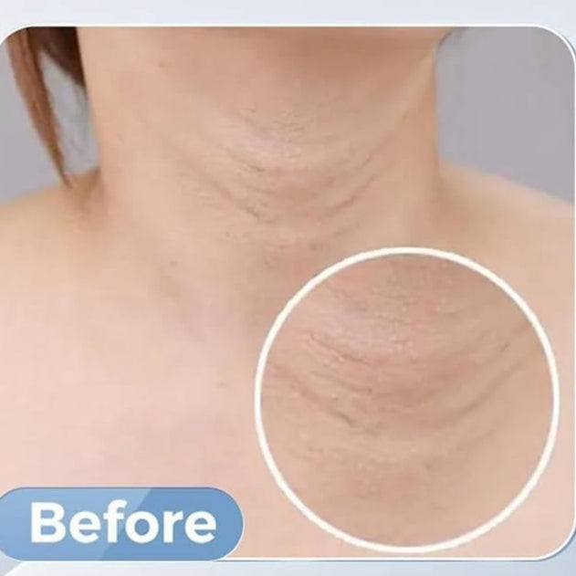 image comparison before