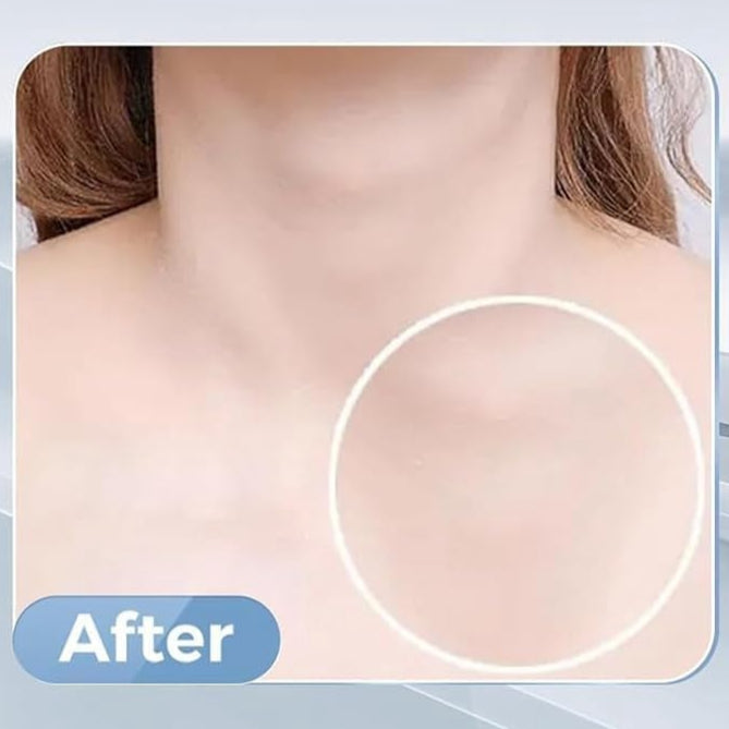 image comparison after